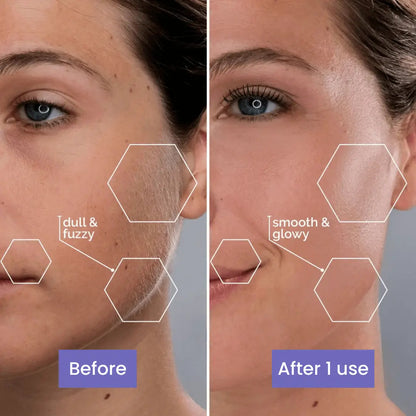 Numea™ Instant Facial Hair Remover