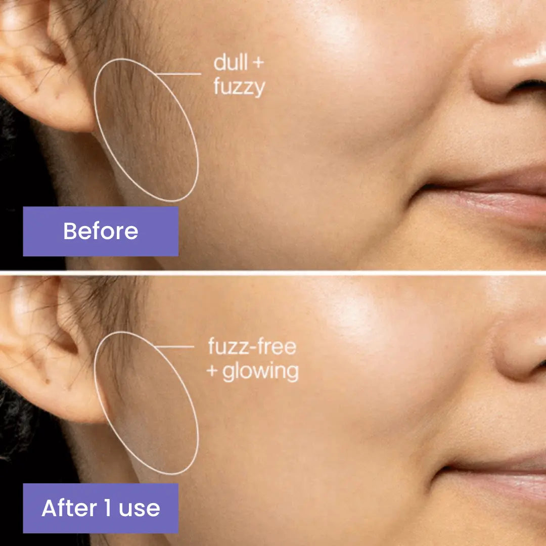 Numea™ Instant Facial Hair Remover